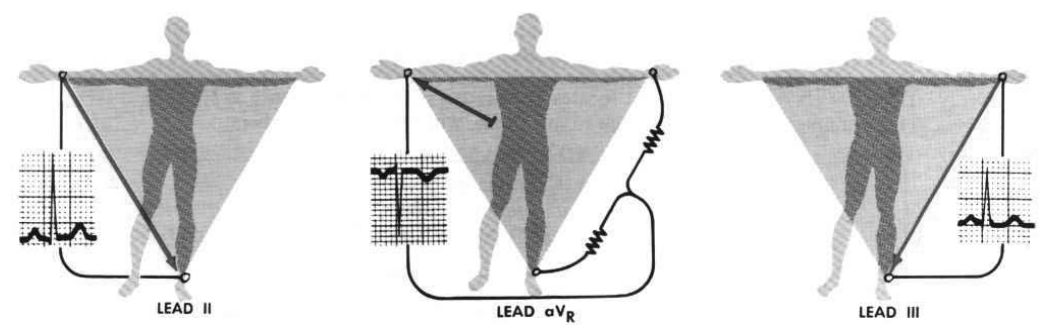 ECG graphs show the component of the moving heart vector along each lead
