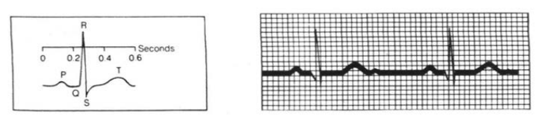 Small helper graph for reading curve features